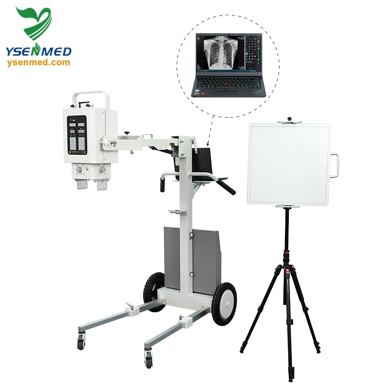 Ysx056-Pd 5.6kw Digital Portable X-ray Machine