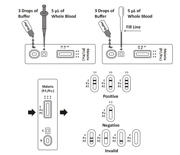 Malaria Pvpf Rapid Detection Instrument