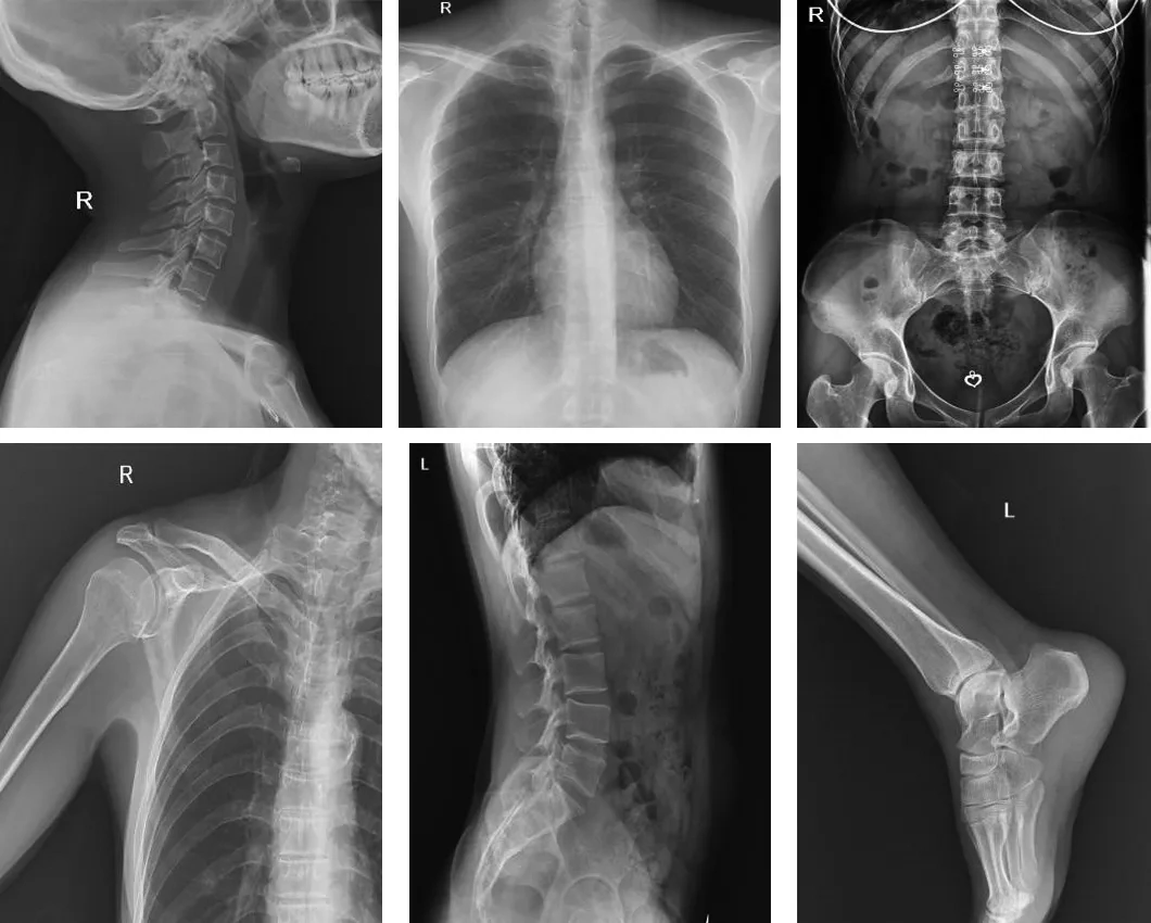 Medical Equipment High Frequency Digital Portable X-ray Machine