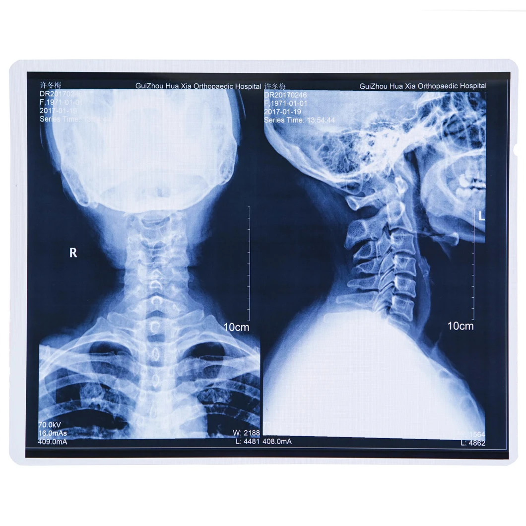 FUJI Printer Using Laser Medical X-ray Film 35X43 Cm